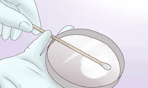 Как берется и расшифровывается мазок на гонорею?