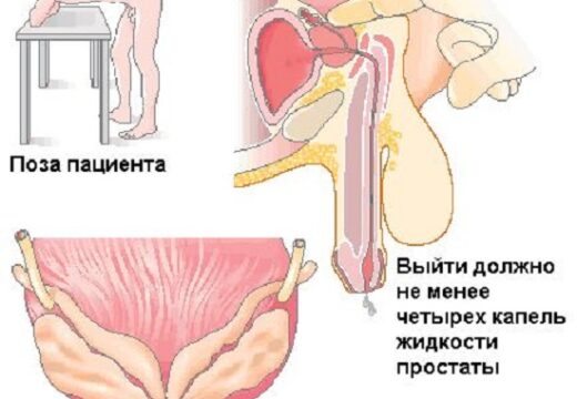 Какими бывают массажеры простаты?