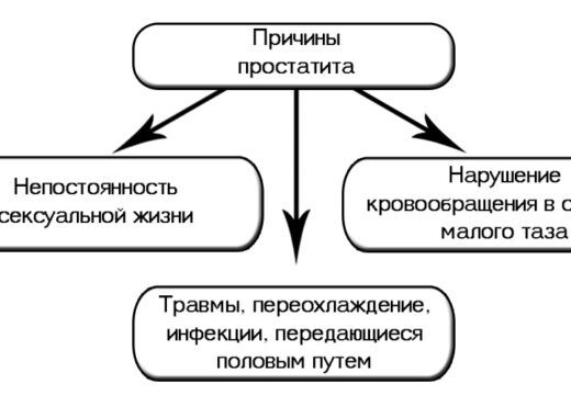 Как распознать острый простатит: лечение и профилактика