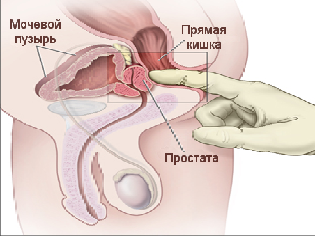 Виды массажа простаты и техника его выполнения своими руками